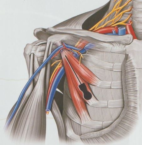 안양 고래한의원 - 흉곽출구증후군