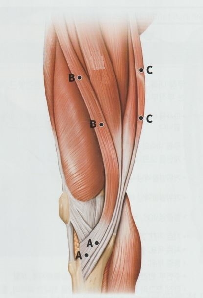 거위발 점액낭염 거위발 활액낭염004
