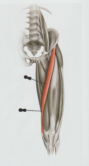 거위발 점액낭염 거위발 활액낭염008