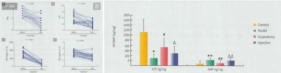 경추 항인대 석회화5