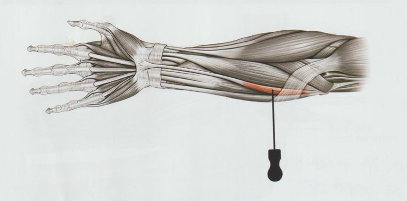 골프 엘보우 주관절 내상과염05