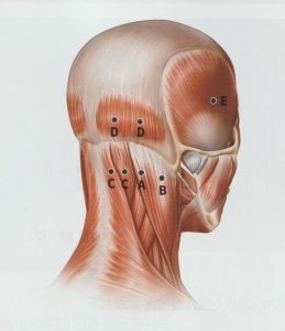 안양 고래한의원 - 긴장성 두통1