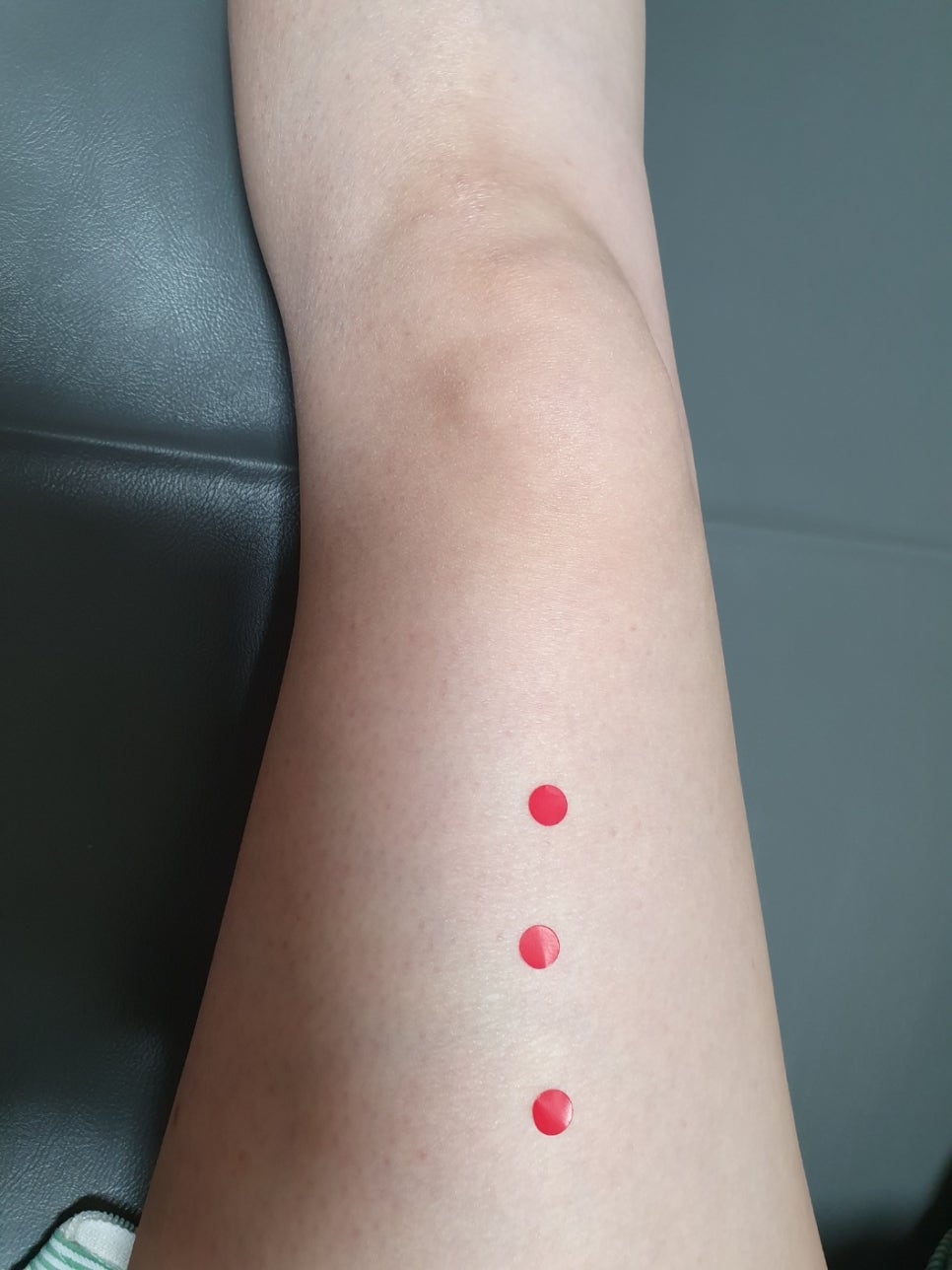 슬개대퇴통증 증후군003