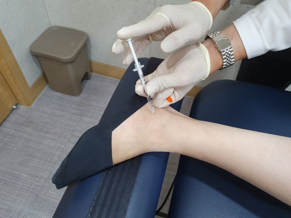 아킬레스 건염 11 아킬레스 건염009