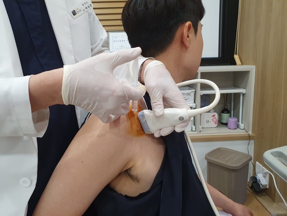 어깨 석회화 건염 9 어깨 석회화 건염07