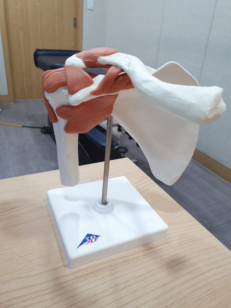 안양 고래한의원 - 어깨 충돌증후군 (견봉하 점액낭염)