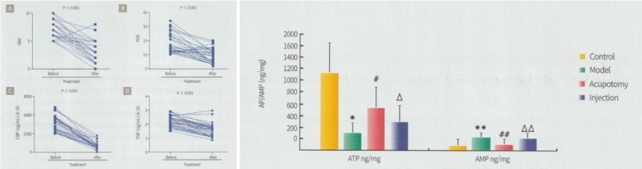어깨충돌증후군10