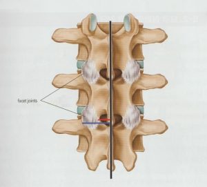 안양 고래한의원 - 요추 후관절 증후군01