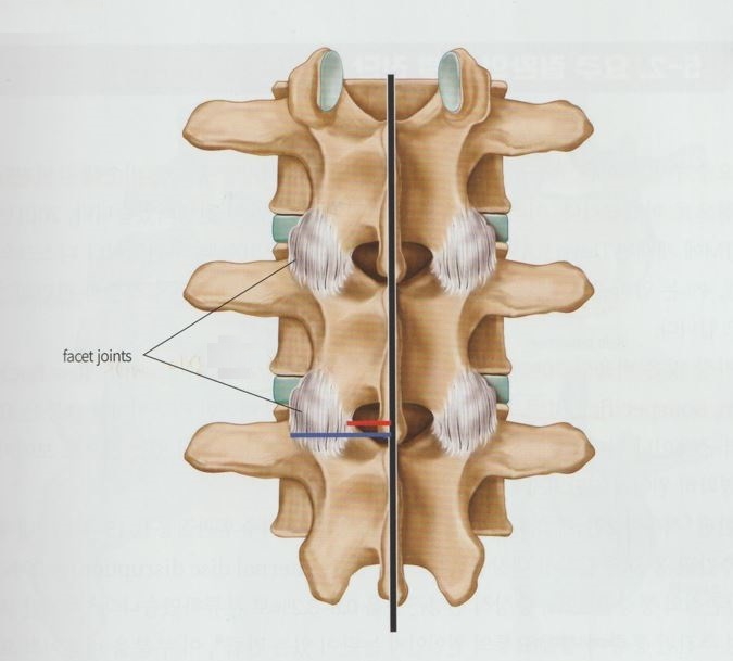 요추 후관절 증후군 2 요추 후관절 증후군01