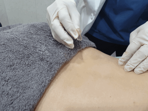 요추 후관절 증후군 6 요추 후관절 증후군8