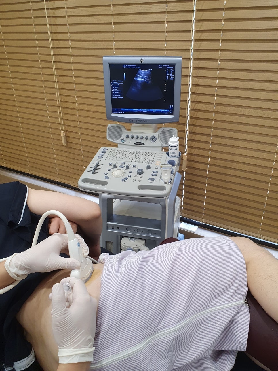 장경인대증후군008