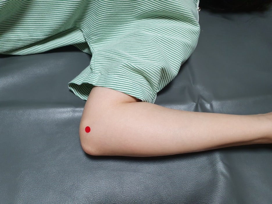 주관 증후군 팔꿈치 터널 증후군04