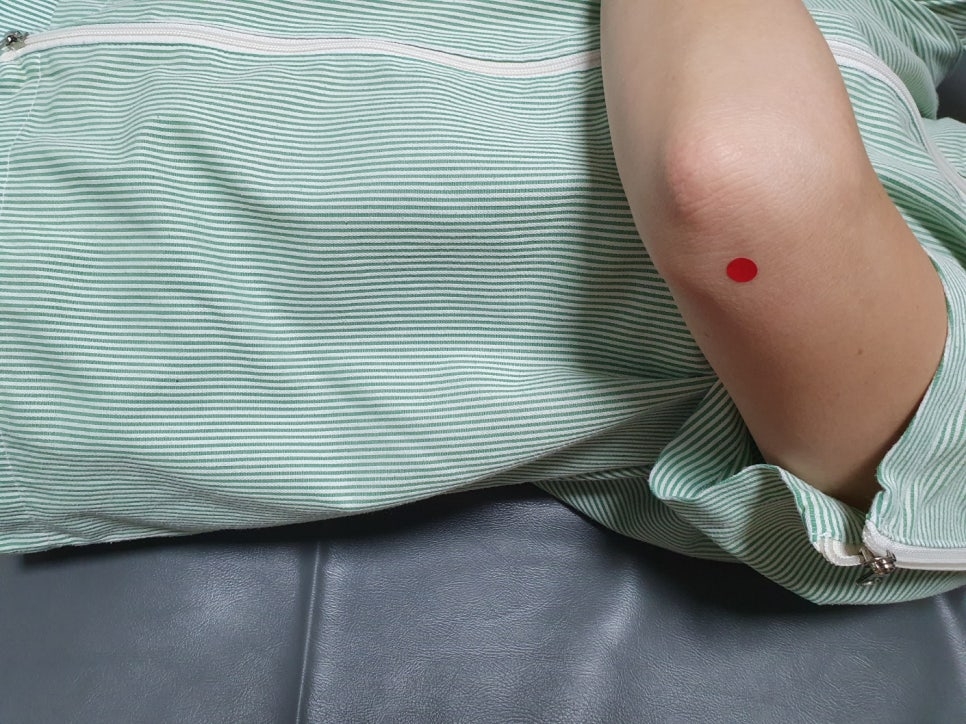 안양 고래한의원 - 주두 점액낭염