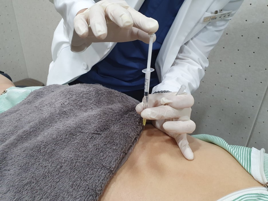 천장관절증후군07