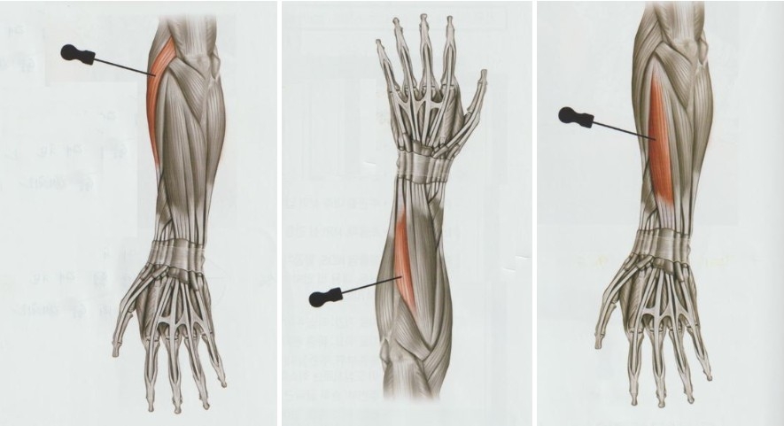 테니스 엘보우 주관절 외상과염05