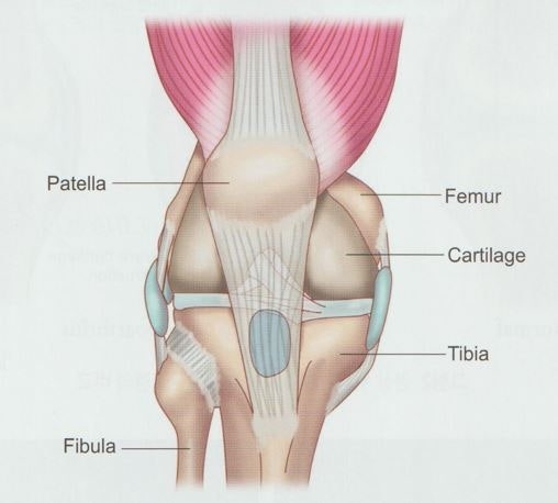 퇴행성 무릎 골관절염002