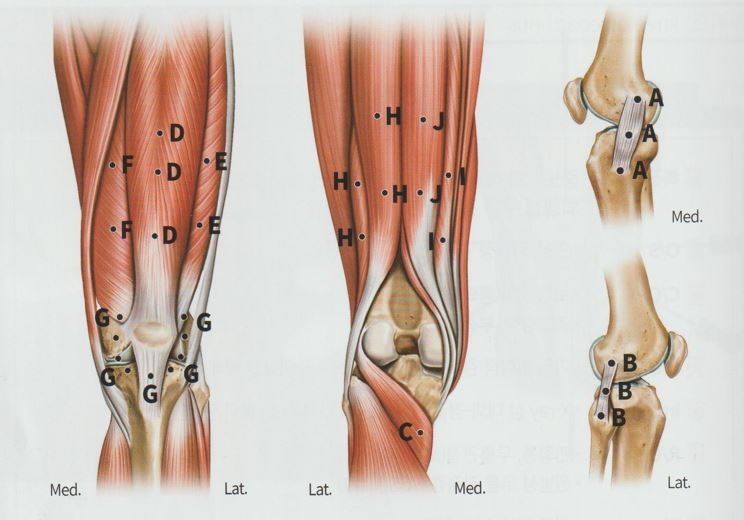 퇴행성 무릎 골관절염003