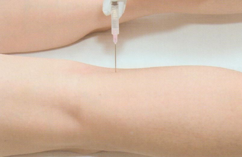 퇴행성 무릎 골관절염011