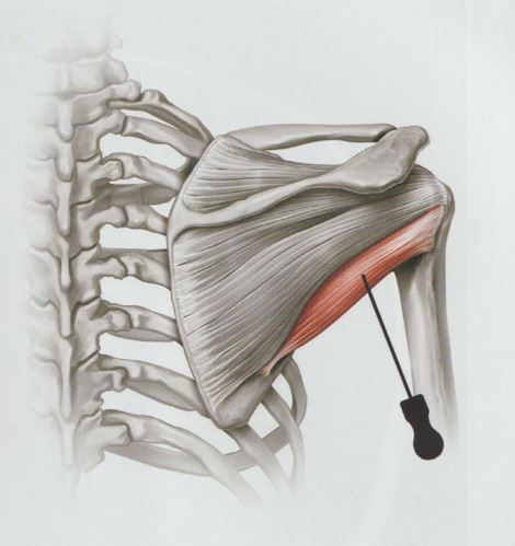 회전근개증후군10